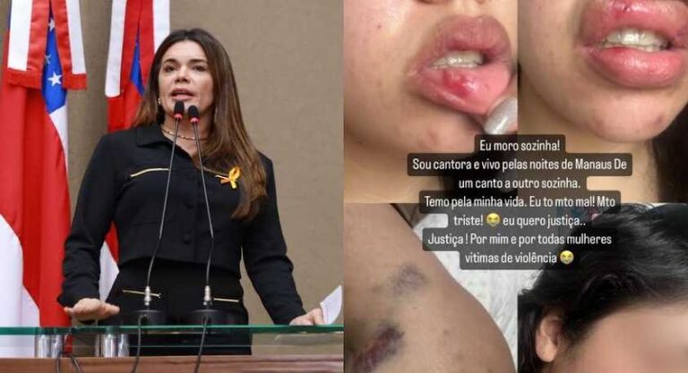 Deputada Alessandra Campelo denuncia lutador de MMA que agrediu ex-namorada em Manaus